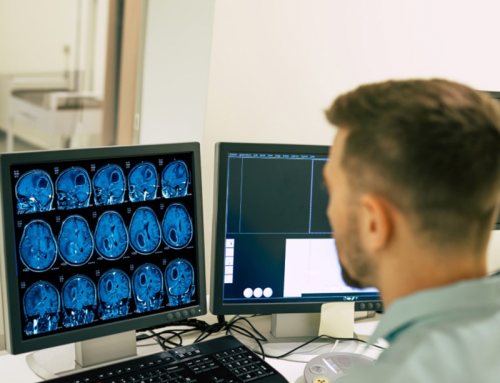 Quando o susto do diagnóstico chega: como lidar com os desafios da Esclerose Múltipla